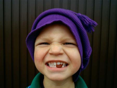 Les carembars sa nique les dents.